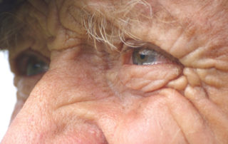 Senior eye health