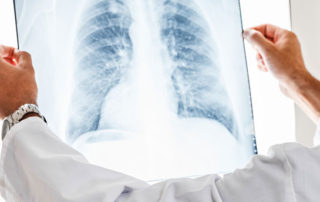 Lung cancer awareness month thm