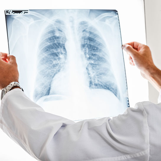 Lung cancer awareness month thm